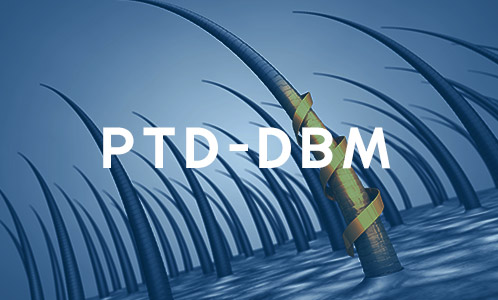 PTD-DBM Que esjpg