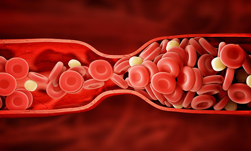 Tesamorelin Beneficios